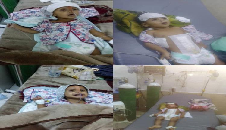 الطفلة عفاف حمدي السبئي ضحية الإهمال الطبي في مستشفى الحياة في مأرب