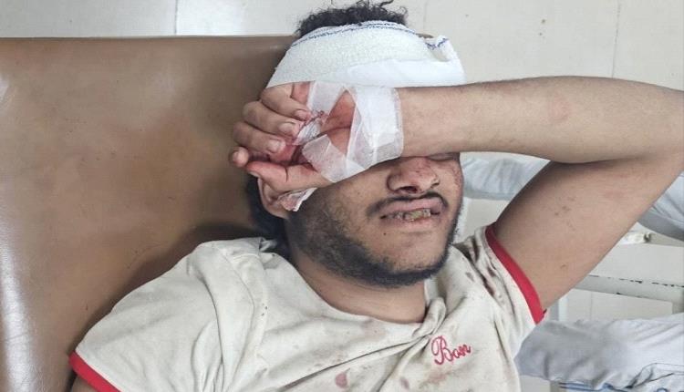 إصابة شاب بجروح خطيرة برصاص قناص حوثي في تعز