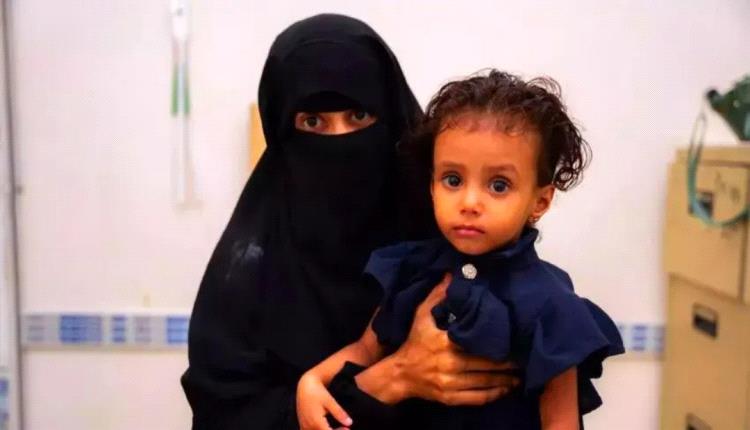 اليونيسف: إطلاق مبادرة تغذوية لتسريع الحد من نقص التغذية في اليمن