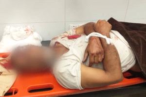 تقرير حقوقي: توثيق 42 انتهاكاً حوثياً وإطلاق 369 مقذوفاً في تعز خلال يومين